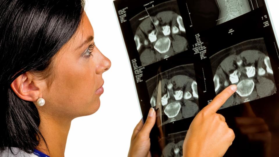 Eine OTA oder ATA schaut sich Röntgenbilder an